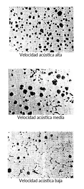 nodularidad - variaciones en la velocidad acústica